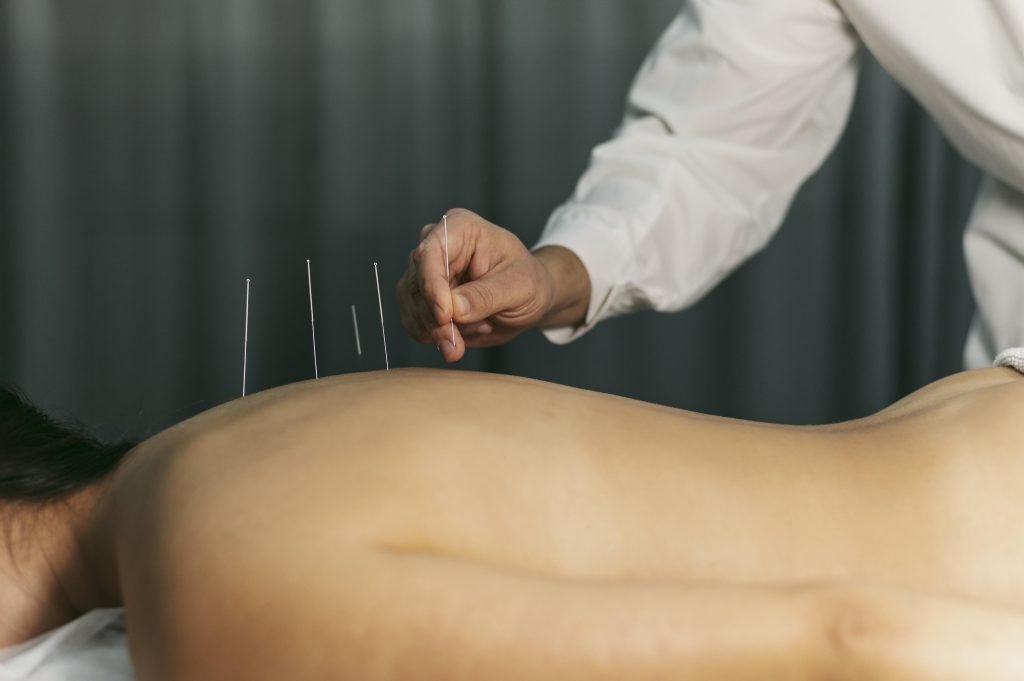 Acupuncturist in Woerden